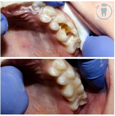 Оптима Дент