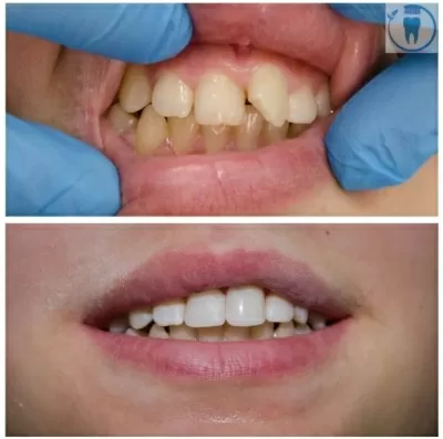 Оптима Дент