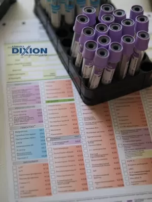 Диксион-Орел