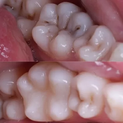 Стоматология Белый Слон