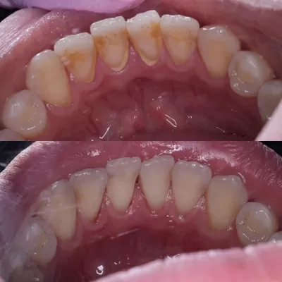 Стоматология Белый Слон