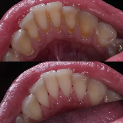 Стоматология Белый Слон