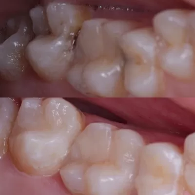 Стоматология Белый Слон