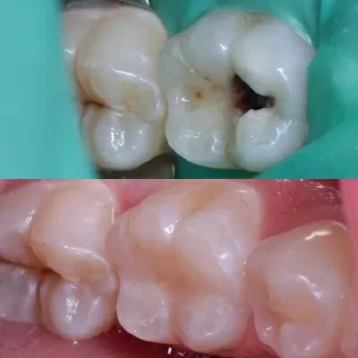 Стоматология Белый Слон