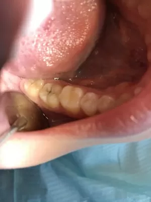 Стоматология Белый Слон