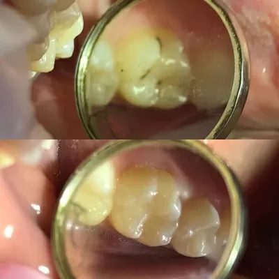 Стоматология Белый Слон