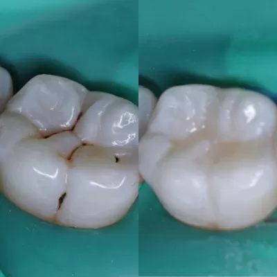 Стоматология Белый Слон