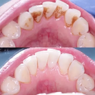 Стоматология Белый Слон