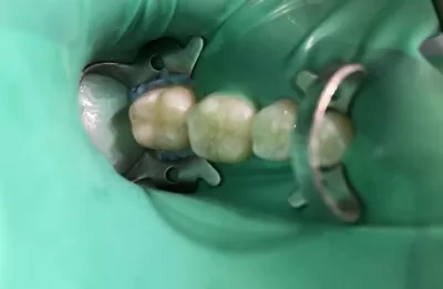 Стоматология Белый Слон