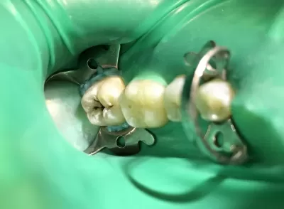 Стоматология Белый Слон