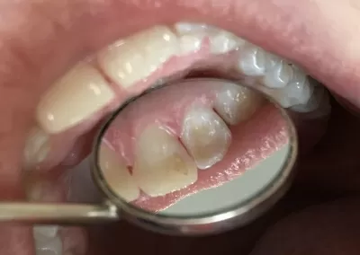 Стоматология Белый Слон