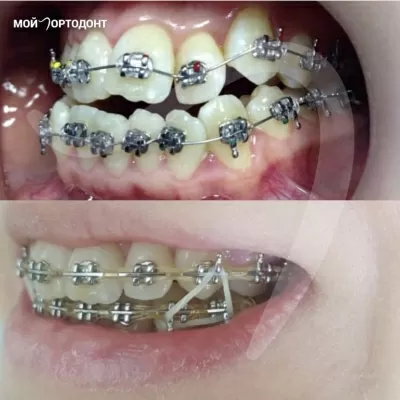 Мой Ортодонт