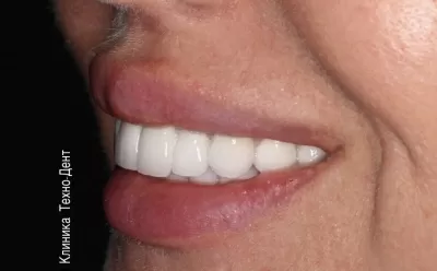 Клиника Техно-Дент