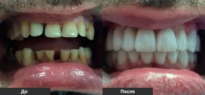 Клиника Техно-Дент