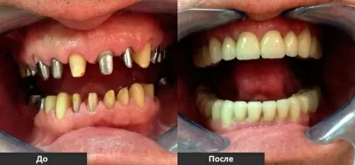 Клиника Техно-Дент