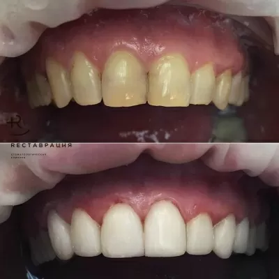 Дент Студио