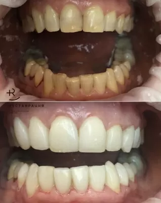 Дент Студио