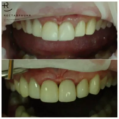 Дент Студио