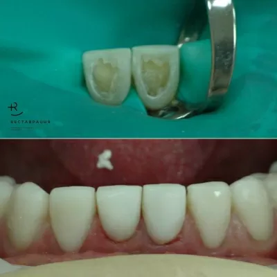 Дент Студио