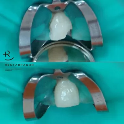 Дент Студио