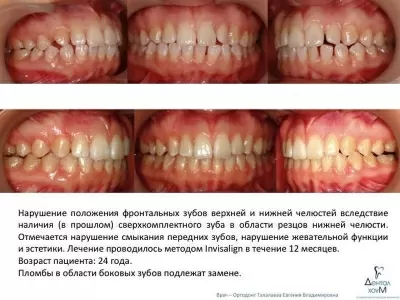 Дентал Хоум