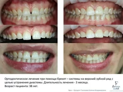 Дентал Хоум