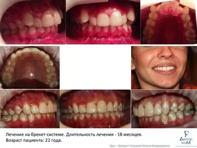 Дентал Хоум