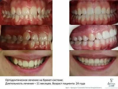 Дентал Хоум