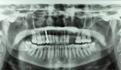 Дентал Хоум