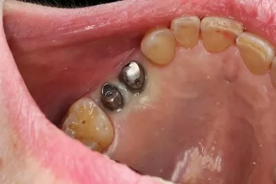 Дентал Хоум