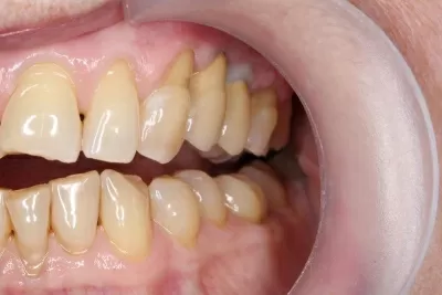 Дентал Хоум