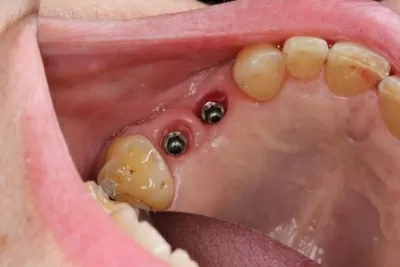 Дентал Хоум