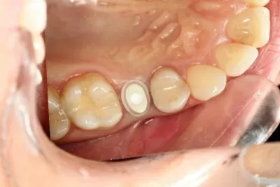 Дентал Хоум