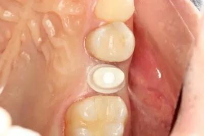 Дентал Хоум