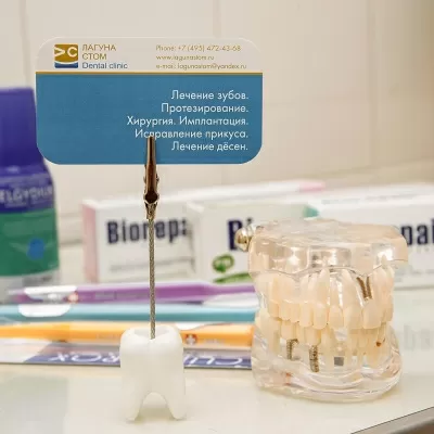 Лагуна Стом