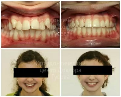 Ортодонтический центр доктора Гусева