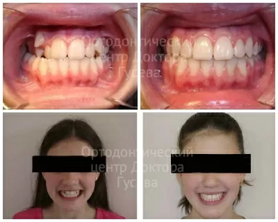 Ортодонтический центр доктора Гусева
