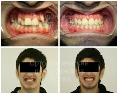 Ортодонтический центр доктора Гусева