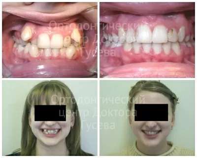 Ортодонтический центр доктора Гусева