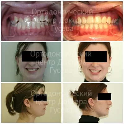 Ортодонтический центр доктора Гусева