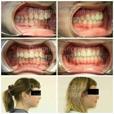 Ортодонтический центр доктора Гусева