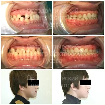 Ортодонтический центр доктора Гусева