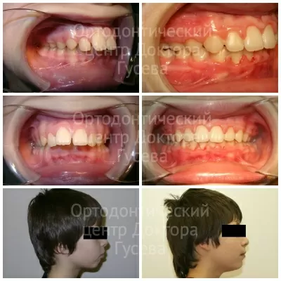 Ортодонтический центр доктора Гусева