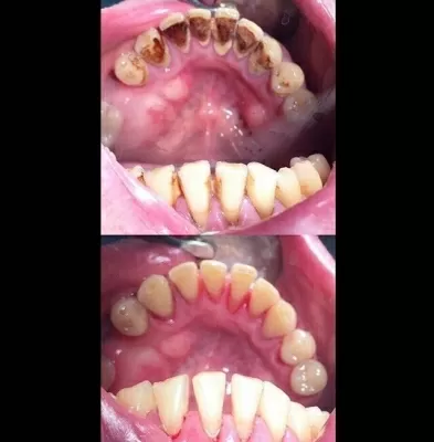 Дентастиль