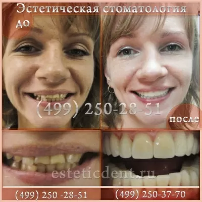 Esthetic dent. Эстетическая стоматология отзывы. Эстетик Дент Павловский Посад. Чек Эстетик Дэнт от стоматологии. Стоматология Эстетик Дент в посадке.