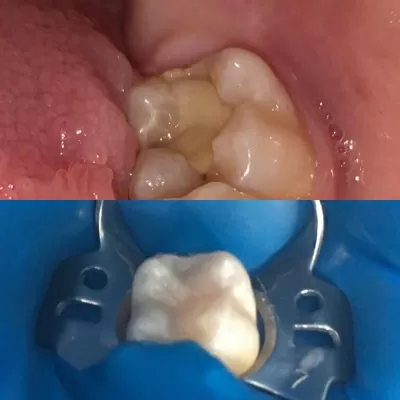 Очень хорошая стоматология