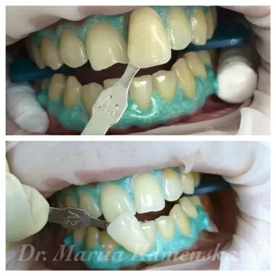 Стоматология Bobrov Clinic