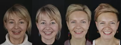 Лаборатория эстетической стоматологии