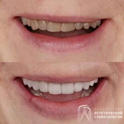 Лаборатория эстетической стоматологии