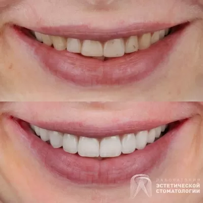 Лаборатория эстетической стоматологии